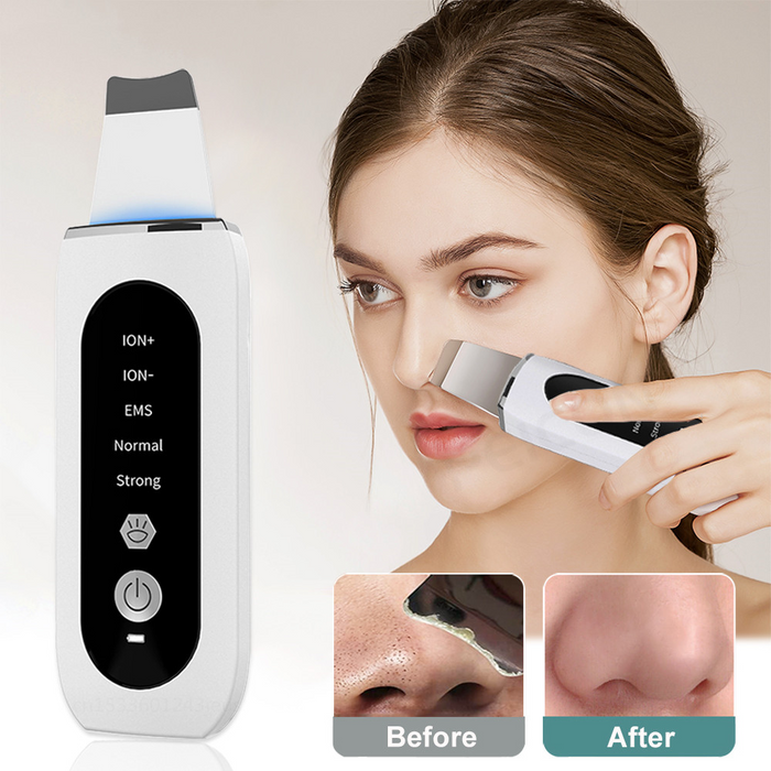 Dispositivo de Limpieza Facial Ultrasónico | LUMORA